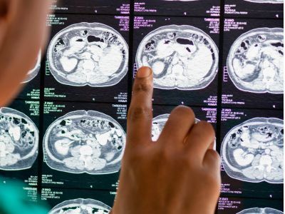 Neuroscience in Denmark